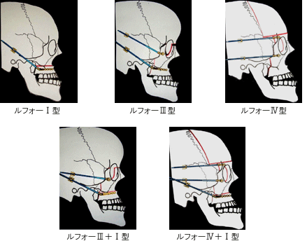 慶應義塾大学医学部 形成外科 頭蓋顎顔面外来