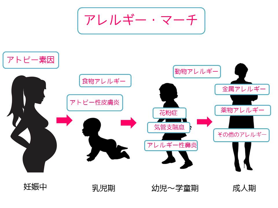 漢方治療 【アレルギー性鼻炎、アトピー性皮膚炎、小児喘息】証〉のた