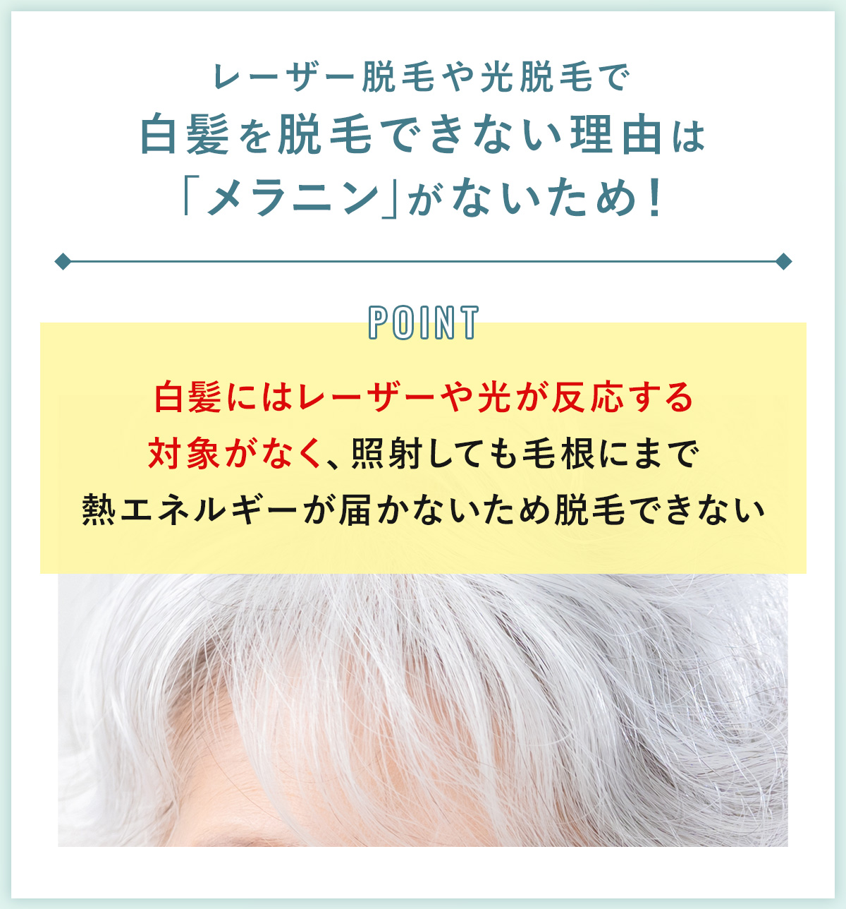 白髪を脱毛できるのはニードル脱毛だけ！白髪脱毛のメリット