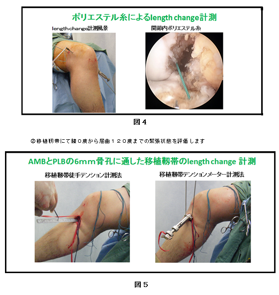 手術実績-貴島整形外科 スポーツ整形外科