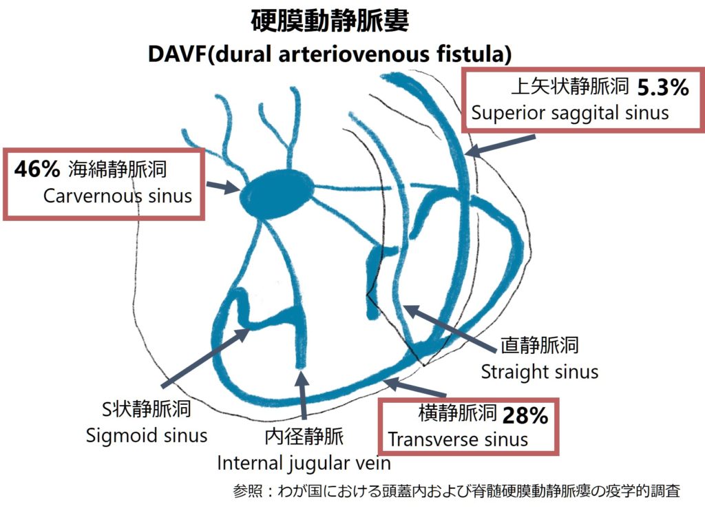 血管奇形まとめ│医學事始 いがくことはじめ