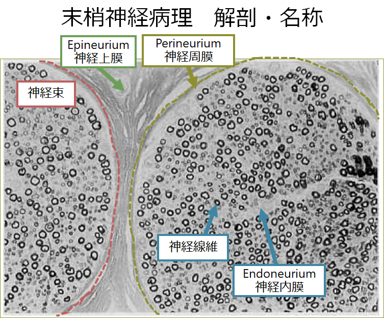 末梢神経病理│医學事始 いがくことはじめ