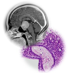 日本間脳下垂体腫瘍学会