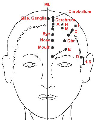 YNSA in English – Yamamoto Neue Schädelakupunktur – YNSA