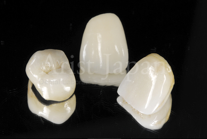 製品紹介｜大阪・歯科技工所 Arist Japan（アリストジャパン）