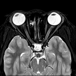 人間ドック 脳ドック・肺ドック｜磯部クリニック｜埼玉県深谷市