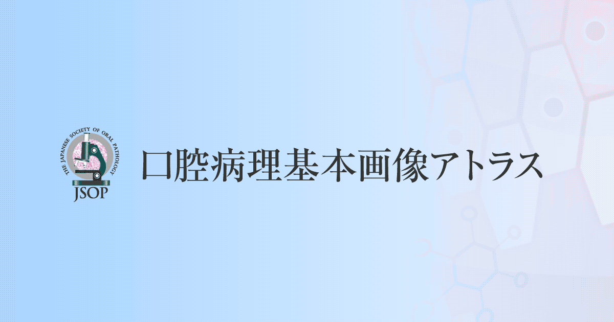 口腔病理基本画像アトラス