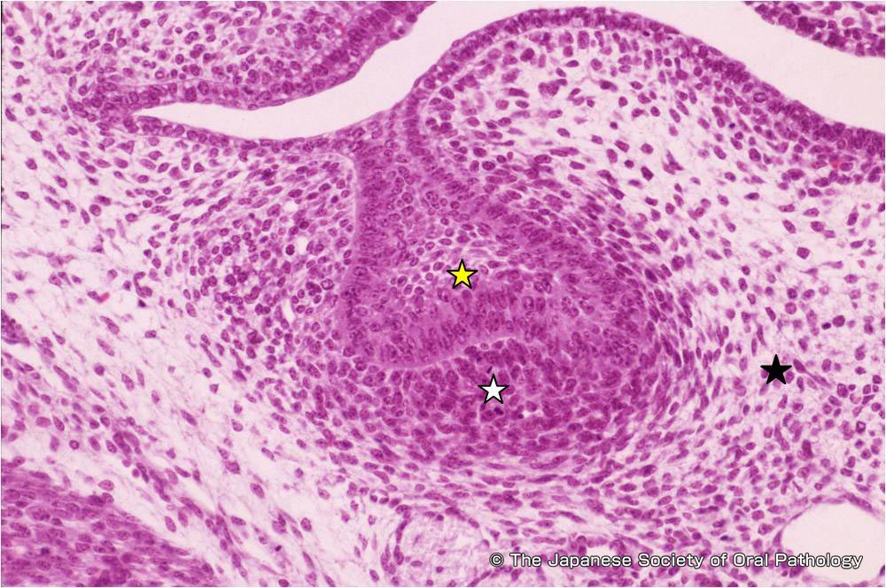 歯の発生と組織学 | 口腔病理基本画像アトラス