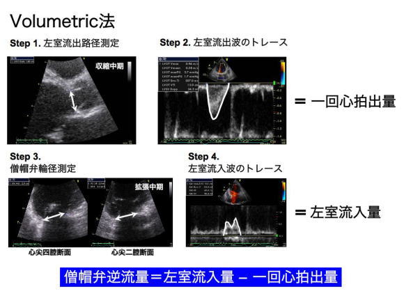 エコー | 愛媛大学医学部 循環器・呼吸器・腎高血圧内科学（第二内科