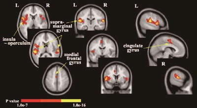 脳神経外科学 | 脳神経外科学