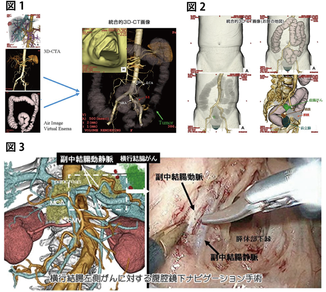 内視鏡ロボット手術センター｜診療科目｜豊中敬仁会病院
