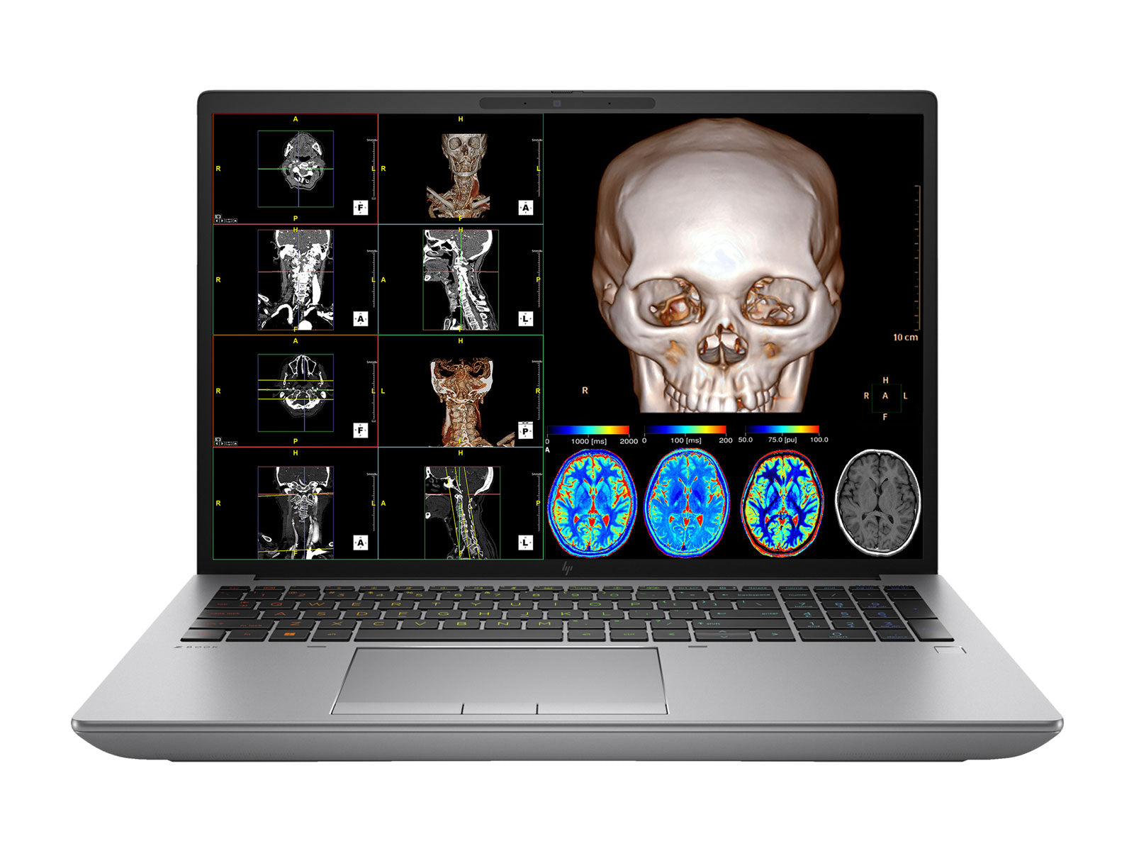 HP ZBook Fury 16 G10: High-Performance Radiology Workstation