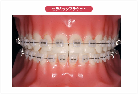 矯正治療について｜根津矯正歯科クリニック