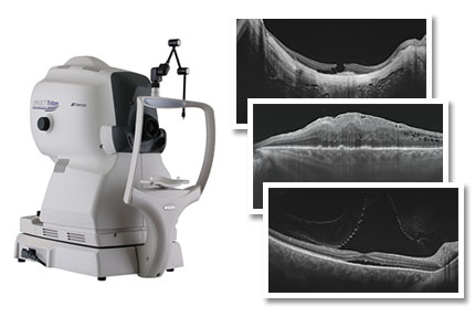 せきや眼科の最新鋭設備の紹介です。