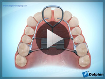 四谷見附矯正歯科 顎顔面矯正クリニック | 顎顔面矯正治療とは