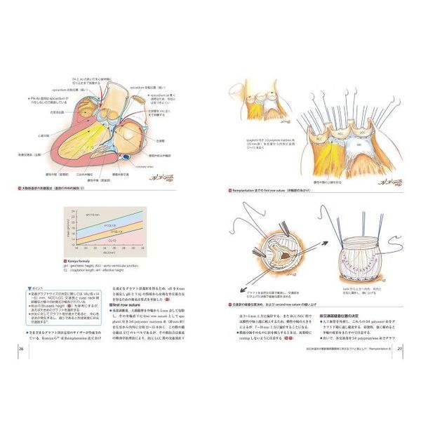 心臓血管外科手術エクセレンス 手術画と動画で伝える 4 大動脈疾患の