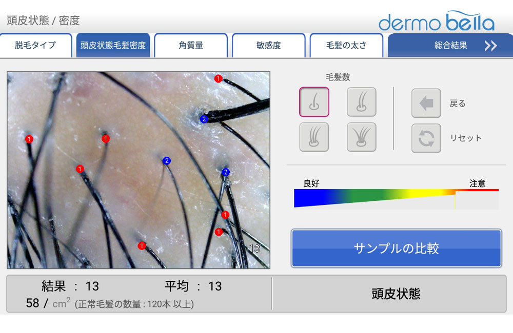 カウンセリングマイクロスコープ頭皮用 3R-WMBTPRIME-H | スリーアール