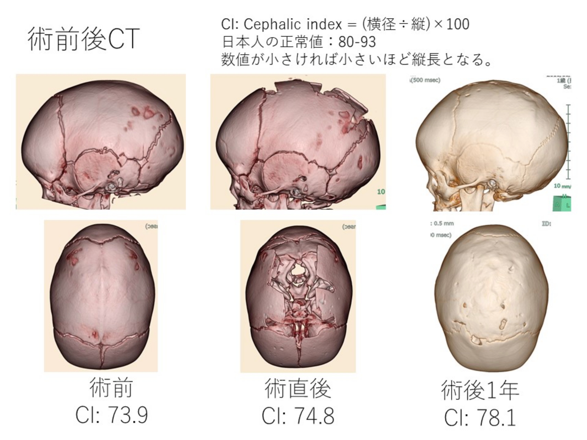 小児脳神経外科｜社会医療法人愛仁会 高槻病院（大阪府高槻市）