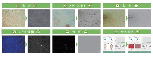 ダーモプライム – 立川No.1実績｜選ばれる整体・鍼灸院｜メディカル