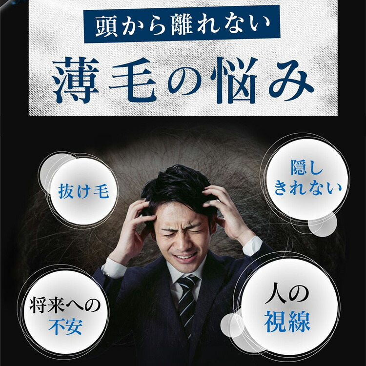 楽天市場】【スーパーセール対象商品】 薬用スカルプローション VO-VO