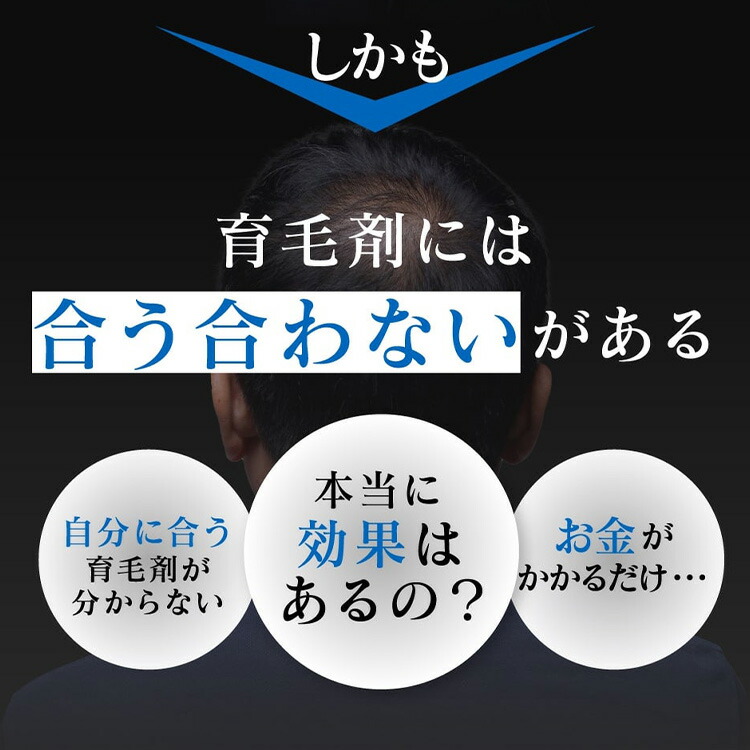 楽天市場】【スーパーセール対象商品】 薬用スカルプローション VO-VO
