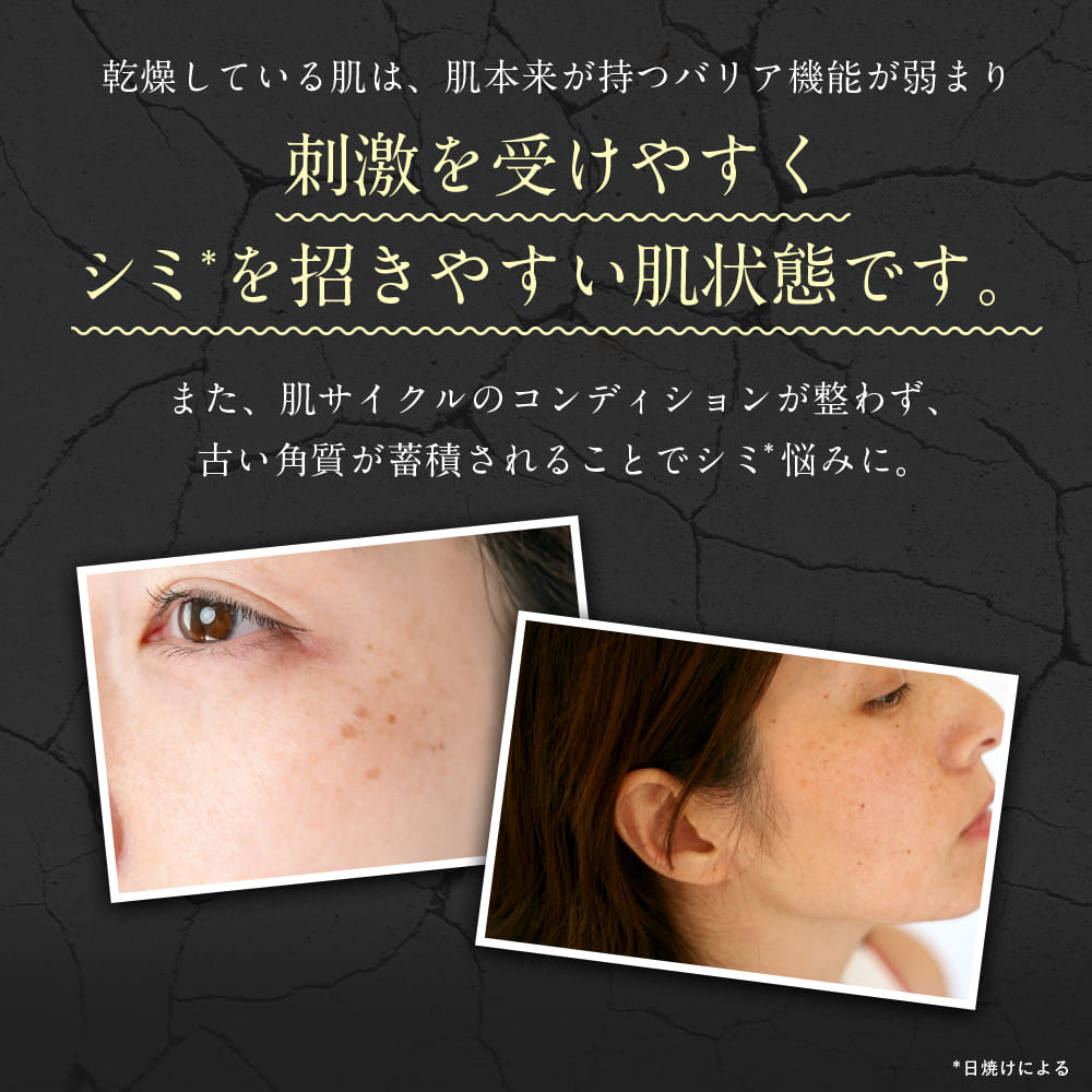 楽天市場】【公式】シミウス 化粧水 医薬部外品 【 シミ取り シミ消し