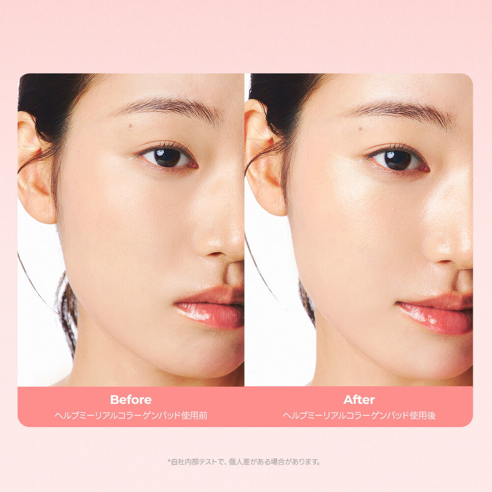 楽天市場】【公式】＼☆送料無料☆／ One-day's you リアルコラーゲン