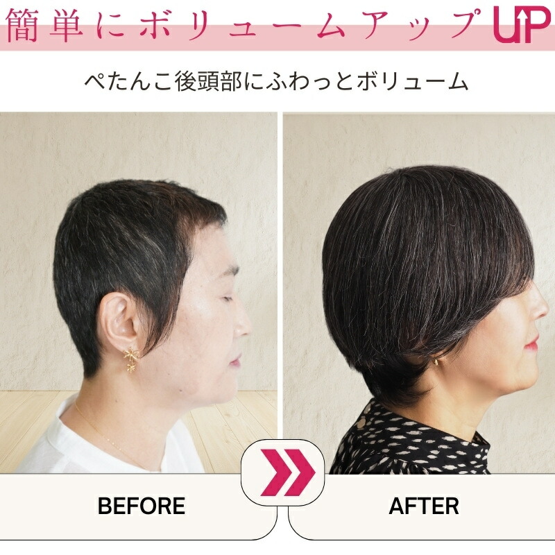 楽天市場】部分ウィッグ 白髪 ウィッグ 人毛 ヘアピース 頭頂部