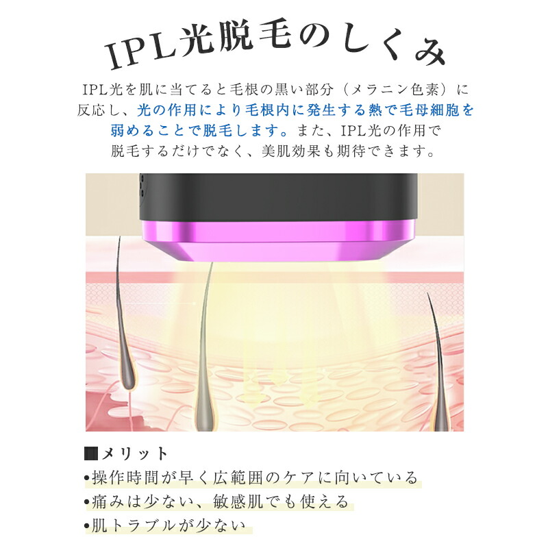 楽天市場】IPL光脱毛器 フラッシュ 家庭用脱毛器 無痛脱毛 5段階強度