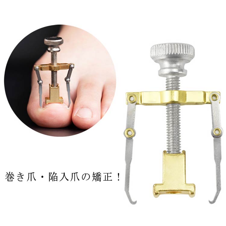 楽天市場】巻き爪 矯正 器具 ケース付き 陥入爪 矯正 ネイルケア