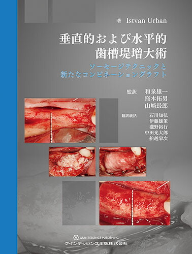 楽天ブックス: 垂直的および水平的歯槽堤増大術 - ソーセージ