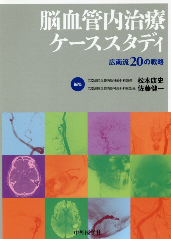 楽天ブックス: 完全版 脳血管内治療学 - 病態・治療法の本質的理解と