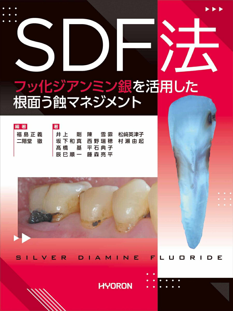 楽天ブックス: ATLASで学ぶ歯科用コーンビームCT診断のポイント64