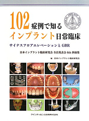 楽天市場】サイナスフロアエレベーションの通販