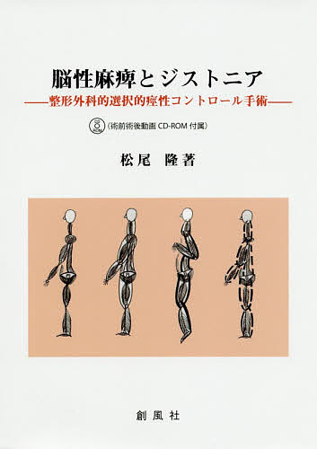 楽天市場】脳性麻痺の整形外科的治療の通販