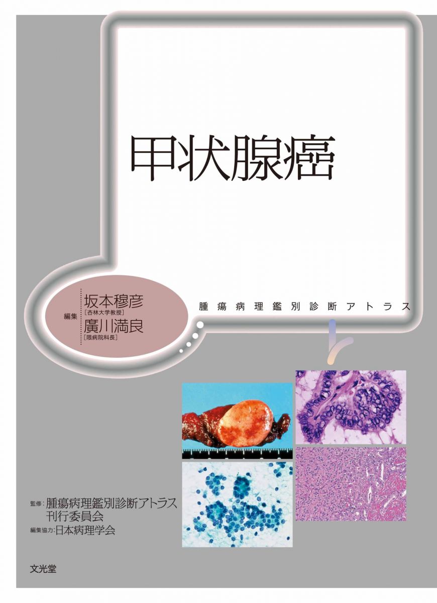 楽天市場】骨髄疾患診断アトラス血球形態と骨髄病理の通販