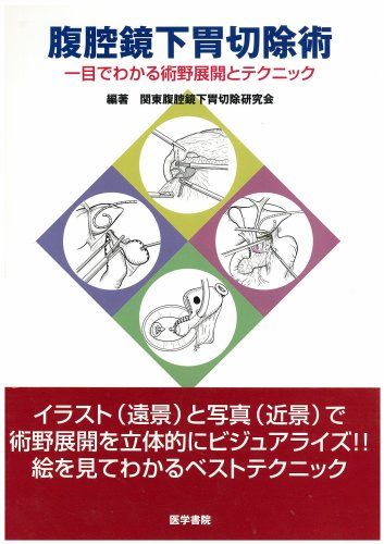 楽天市場】令和スタイル鏡視下胃手術のすべての通販