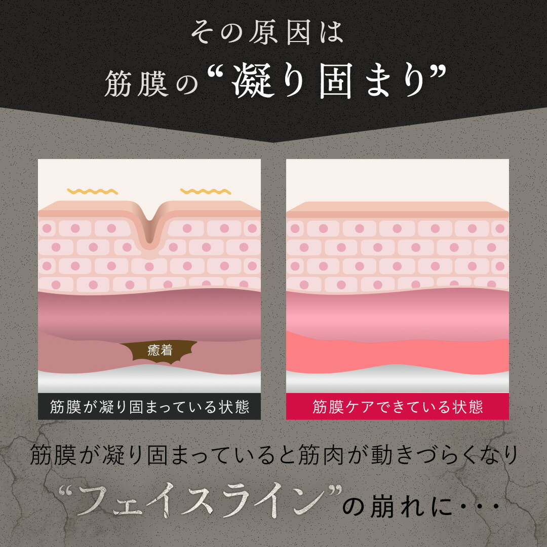 楽天市場】[ｴﾝﾄﾘｰ最大P22倍1日23:59ﾏﾃﾞ]リフトショット Liftshot