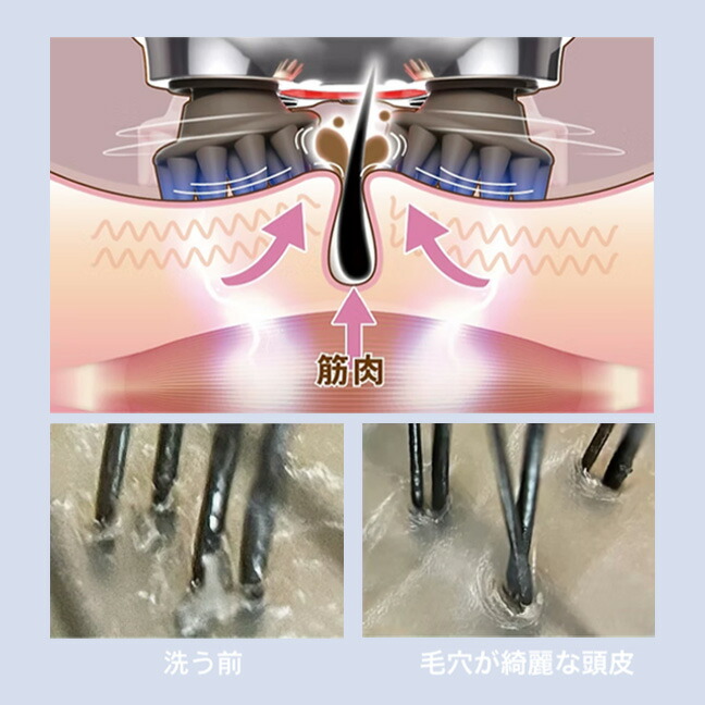 楽天市場】【正規品販売店・送料無料】ゾーガンキン スカルプ CL-ZKS