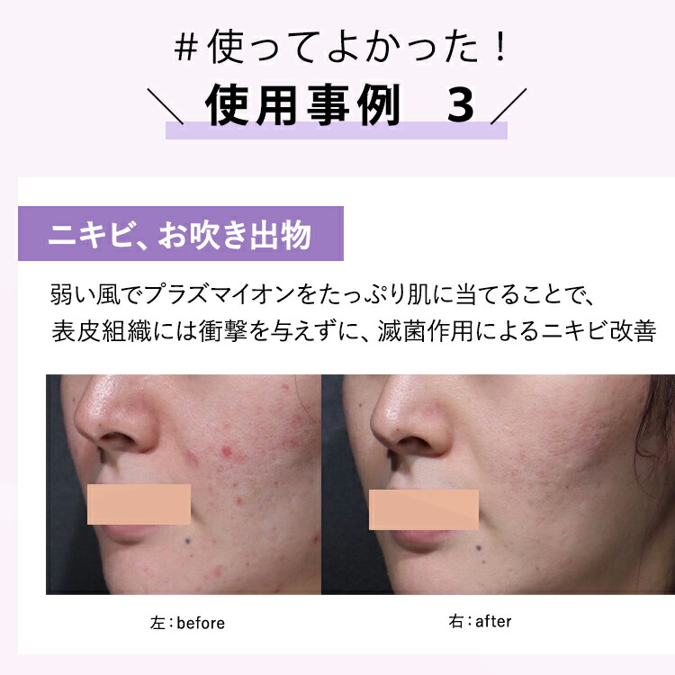 楽天市場】【公式】☆2,000円OFFで65,780円 ⇒63,780円+ギフト