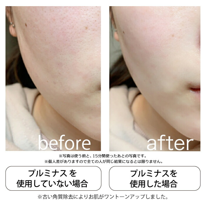 A6188☆mous. PLUMINUS 超音波エステ美顔器mous-16418 JAPAN GALS