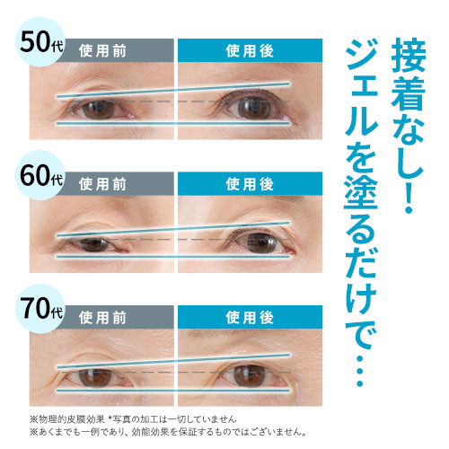 楽天市場】【2本セット】 まぶた 引き上げ ジェル 『リッドキララ