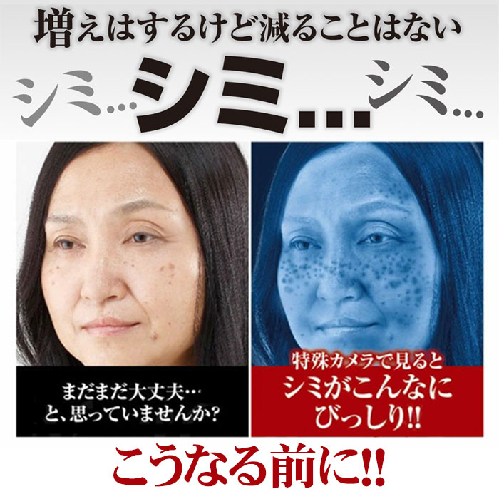 楽天市場】黒ずみ シミケア【薬用クロパックン プレミアム 30g】シミ