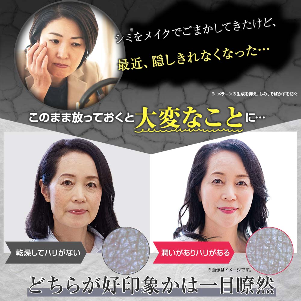 楽天市場】【シワ改善クリーム】ラップリフト 薬用 ナイアシンアミド