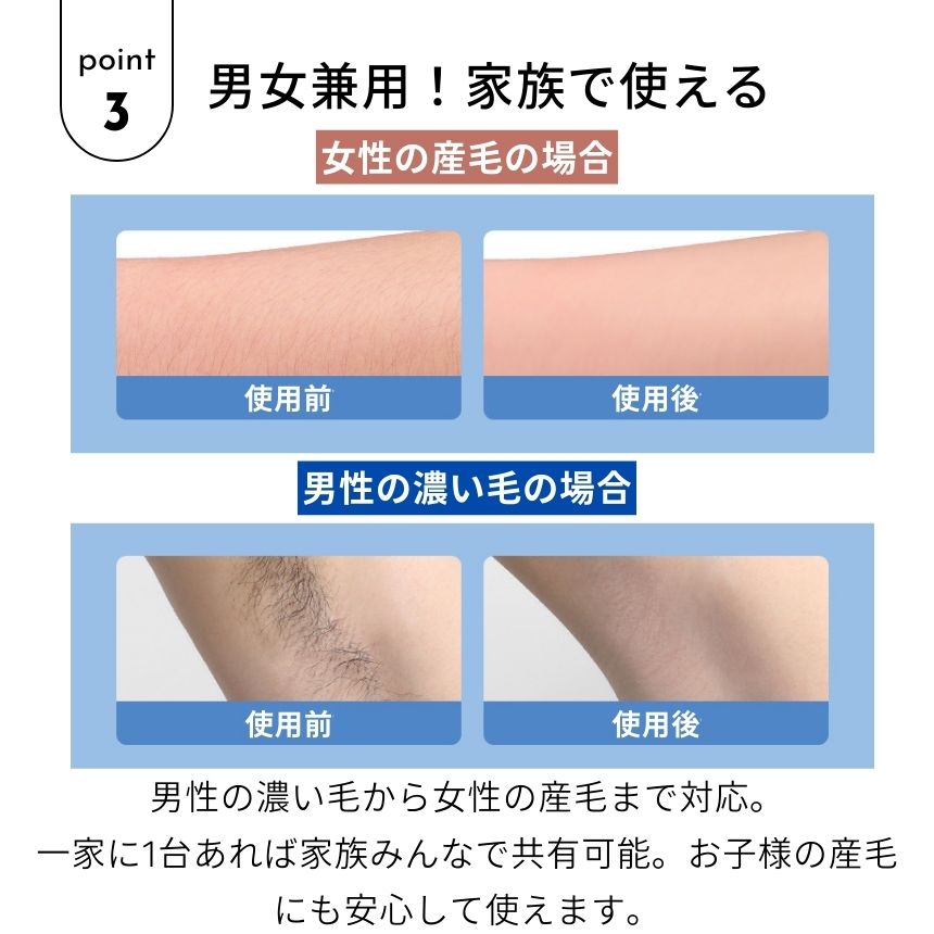 楽天市場】脱毛器 ボディトリマー 脱毛 除毛 ナノガラス ナノ