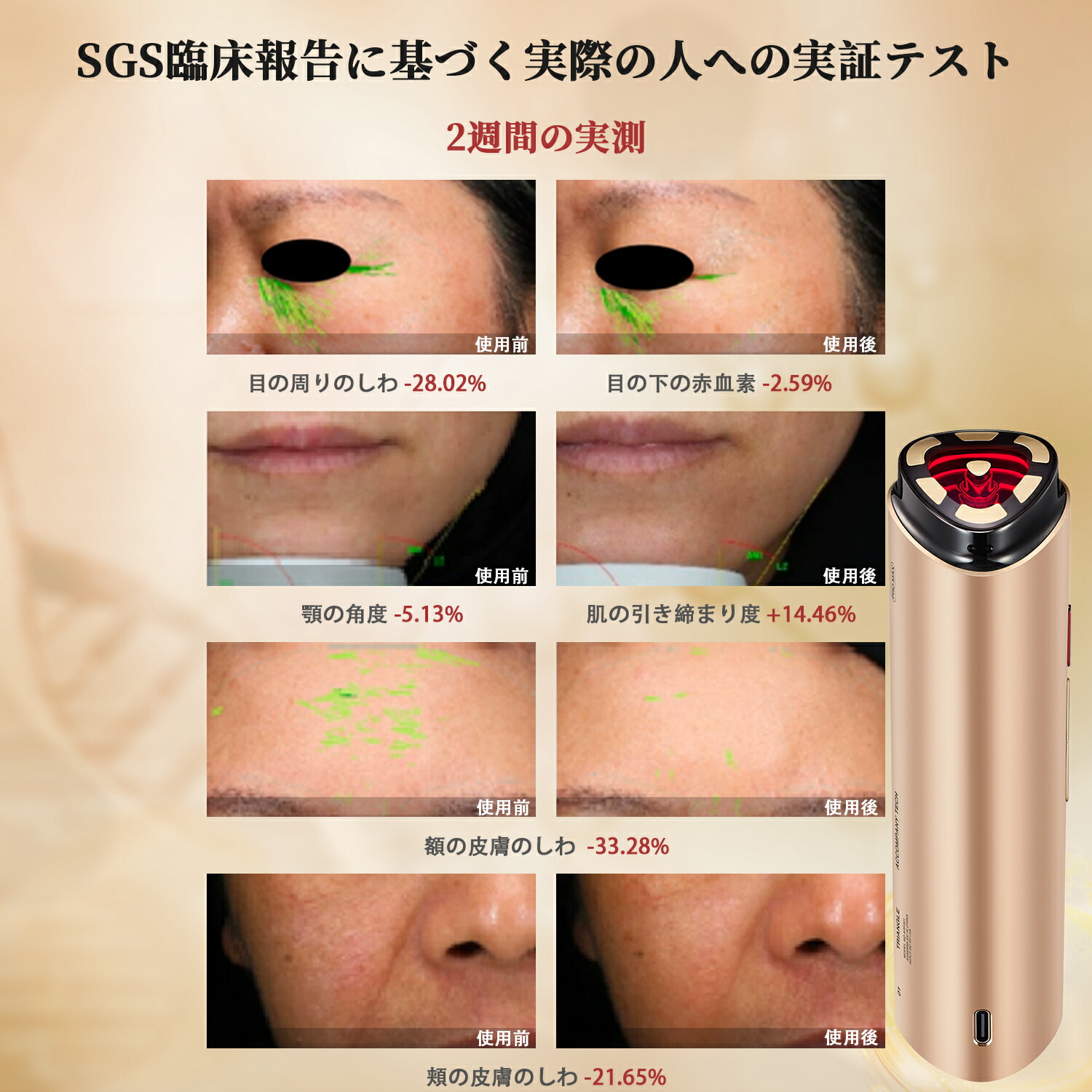 楽天市場】【ミラープレゼント中!】AMIRO アミロ 公式 美顔ローラー RF