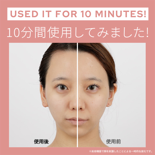 楽天市場】美顔器 ブラシ 頭皮 【ヤーマン公式】《ミーゼ スカルプ