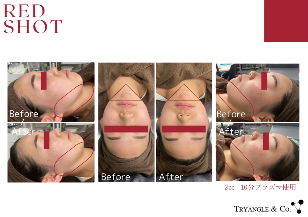 RED SHOT レッドショット - 美容メーカー|トライアングルアンドコー