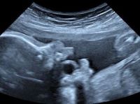 所見から探る産科超音波診断