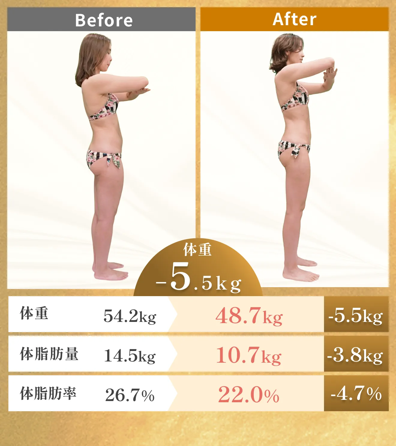 機械施術 - Snoer（脂肪冷却装置）